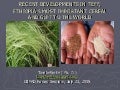 0940 Recent Developments in Teff, Ethiopia's Most Important Cereal and Gift to the World