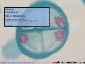 IB Biology AHL 10.1: Meiosis