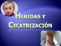 1 Heridas Y Cicatri