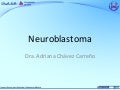 6.  Neuroblastoma Pediatría