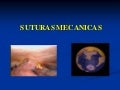 Aplicaciones sutura mecánica endoscópica - CICAT-SALUD