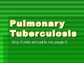 Pulmonary Tuberculosis