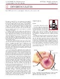 Acs0512 Diverticulitis 2004
