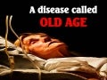 A DISEASE CALLED OLD AGE!