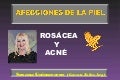 Afecciones de la piel