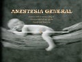 Anestesia general