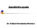 Apendicitis aguda