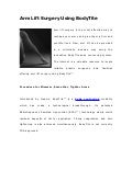 Arm lift surgery using bodytite