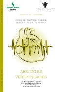 Arritmias Ventriculares