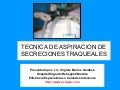 Aspiracion Secreciones