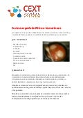 Cocina española: atún a la marinera