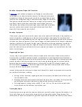 Bone Spur Symptoms, Diagnosis & Treatment 