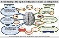 Brain dump