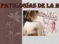 Ca de mama   cirugía