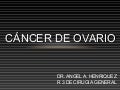 Ca de ovario 