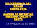 Cancer de Intestino delgado, colon y recto