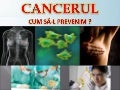 Cancerul By Lucas (Only Women) Max