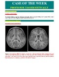 Case record...Cerebral palsy