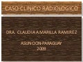 Caso Clínico Radiológico- Absceso pulmonar