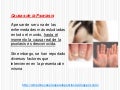 Causas de la psoriasis