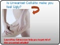 Celrase is a effective cream to remove cellulite on legs
