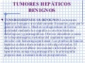 Cáncer hepatico primario y secundarioy tumores benignos del hígado