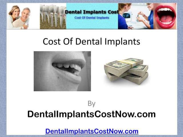 Cost of Dental Implants