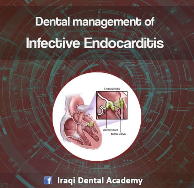 SUBACUTE BACTERIAL ENDOCARDITIS and ANTIMICROBIAL PROPHYLAXIS