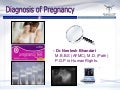 Diagnosis Of Pregnancy