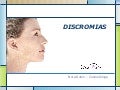 Discromias