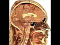 Human Brain