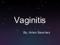 document.php?documentName=Vaginitis