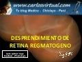 DESPRENDIMIENTO DE RETINA REGMATOGENO