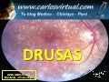 Drusas