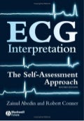 Ecg interpretation