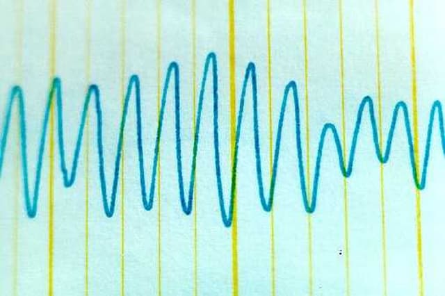 Definition of Some conventional EEG terminologies