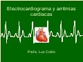 Electrocardiograma y arritmia