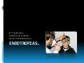 Endotropias