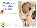 Facial fractures   the upper face
