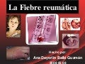 Fiebre reumática
