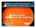 Fondo De Ojo   Angiografia de la Retina