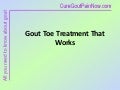Gout Toe Treatment That Works