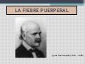 La fiebre puerperal. Grupo 6