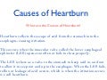 Heartburn Causes