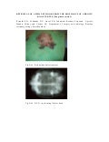 Hook retrieval from esophagus of turtle