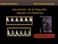 Importancia Ecografia Doppler Obstetricia