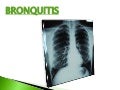 bronquitis y cuidados de enfermeria