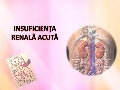 Insuficiența renală acută 
