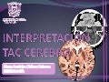 INTERPRETACION DE ANATOMIA CEREBRAL EN UNA TAC CRANEAL