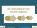 Intraoperative Monitoring